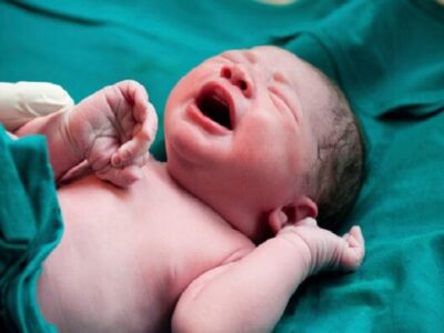 وقتی عمل سزارین مد می‌شود/ چرا زایمان طبیعی به حاشیه رفت؟