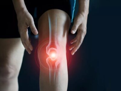 آنچه باید درباره زانوی پرانتزی و دردهای زانو بدانید